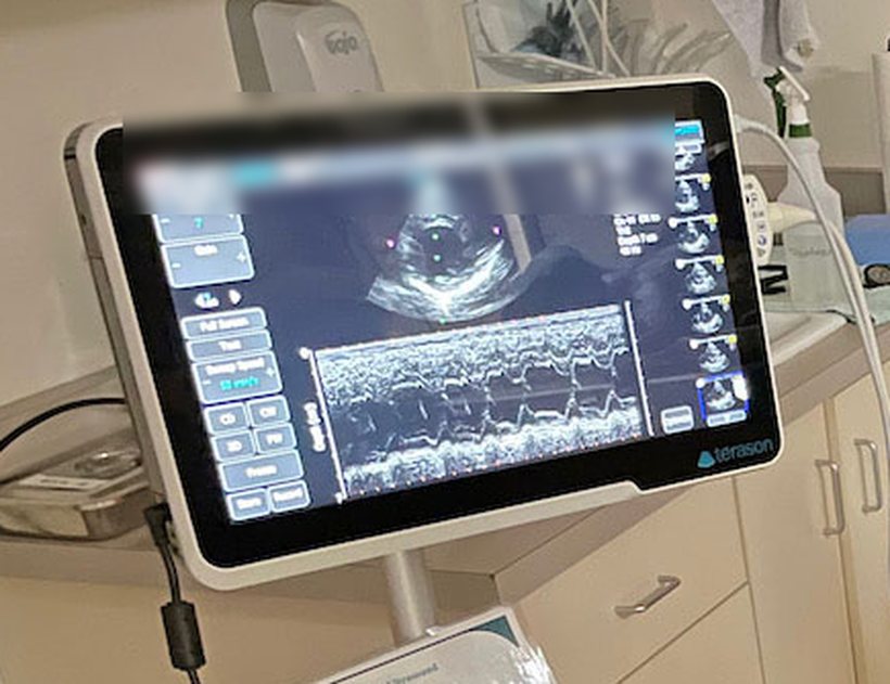 A cardiac ultrasound in progress, showing a two-dimensional heart view above an M-mode trace